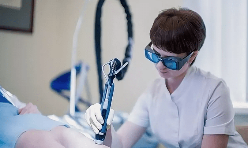 Zdravljenje varikoznih žil z laserjem