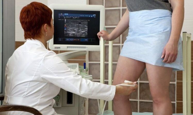 Laserska koagulacija za zdravljenje varikoznih žil