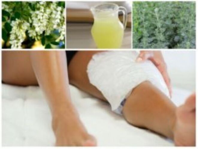 Zelo učinkovita ljudska metoda za zdravljenje krčnih žil je uporaba obkladkov.