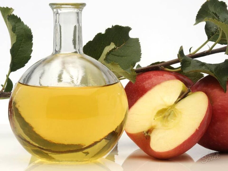 jabolčni kis za krčne žile